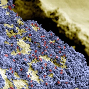 نوع من البكتيريا الغريبة التي تتواجد داخل فم الانسان، وذلك باستخدام ميكروسكوب خاص، وظهرت شبيهة بنباتات نادرة