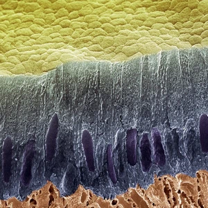 صورة للبكتيريا الغريبة