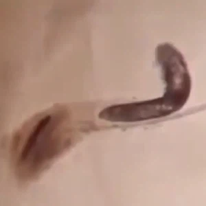 بالفيديو: حشرة غريبة تعيش على وجوه جميع البشر 