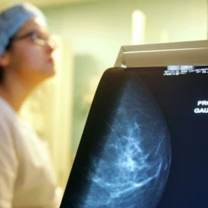 الجزائر تسجل 12 ألف حالة جديدة لسرطان الثدي سنويا