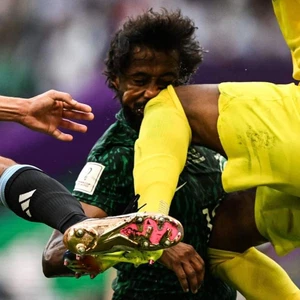 World Cup 2022 | Yasser Al-Shahrani suffered a fracture in the jaw and facial bones, and damage to the teeth, and he will undergo urgent surgical intervention