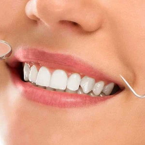 ما هي ابتسامة هوليوود؟ ومتى يتم اللجوء إليها؟