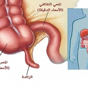 ماذا سيحدث لو لم تكن الزائدة الدودية موجودة في أجسامنا