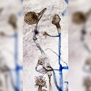 هل مرض الفطر الأسود معدي