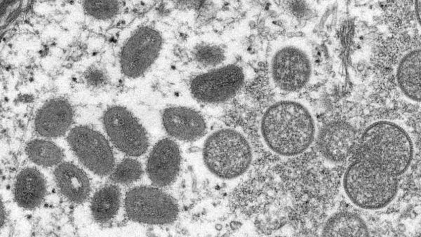 Les EAU annoncent le premier cas de monkeypox