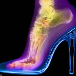 صور جميلة لأشياء تم تصويرها باستخدام الأشعة السينية 