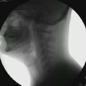 شاهد ماذا يحدث عند اكل او شرب شيء بواسطة أشعة XRAY