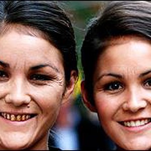 بالصور : مشاهد لمجموعة توائم أحدهم مُدخن و الآخر لا يُدخن .. شاهد الفرق