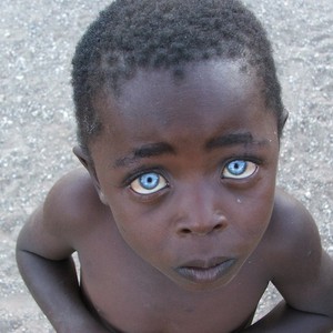 طفل إفريقي يذهل العالم بدفاعه عن إخوانه ضد الغرباء