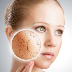 في الشتاء.. تخلص من جفاف البشرة مع هذه الوصفة