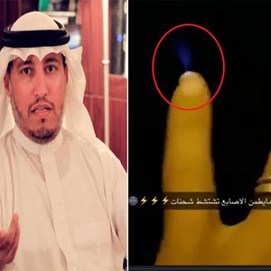 اغرب فيديو ستراه اليوم | أصبع شاب سعوي يتوهج كشعلة زرقاء خلال عاصفة رعدية يثير الجدل .. والمسند يرد