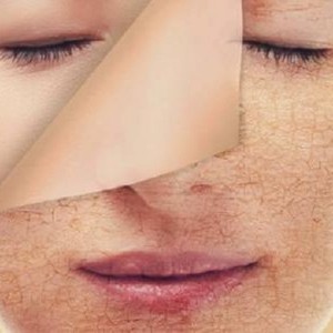 طريقة التخلص من جفاف الجسم في الصيف