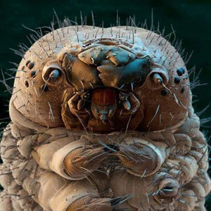 بالصور | هذا الكائن يعيش على وجوه كافة البشر!