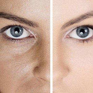 خلطات لتفتيح البشرة الداكنة بأسرع وقت في الخريف