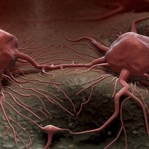 تعرف على علاقة الظروف الجوية بالإصابة بالسرطان