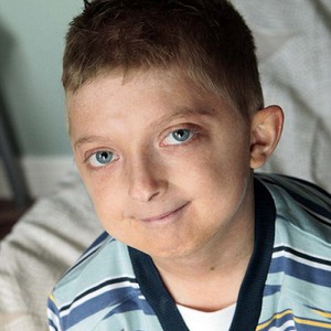 بالصور.. ظاهرة حيرت العلماء.. طفل عمره 50 عاماً