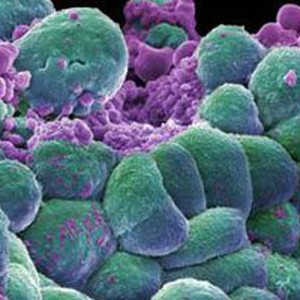 العلماء الروس يبتكرون دقائق نانومترية لعلاج الأمراض الصعبة