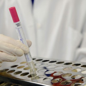 وزارة الصحة: لا إصابات جديدة بكورونا 