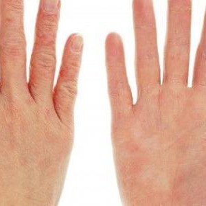 عادات تسبب جفاف اليدين في الشتاء