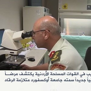 بعد الإنجاز الأردني باكتشاف علاج للسكري .. "متلازمة الرقاد" انجاز طبي جديد 