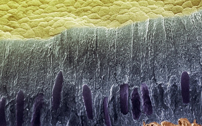 صورة للبكتيريا الغريبة