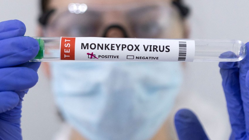 L&#39;OMS déclare l&#39;urgence mondiale face à l&#39;épidémie de monkeypox