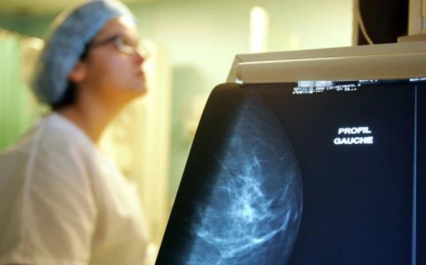 الجزائر تسجل 12 ألف حالة جديدة لسرطان الثدي سنويا