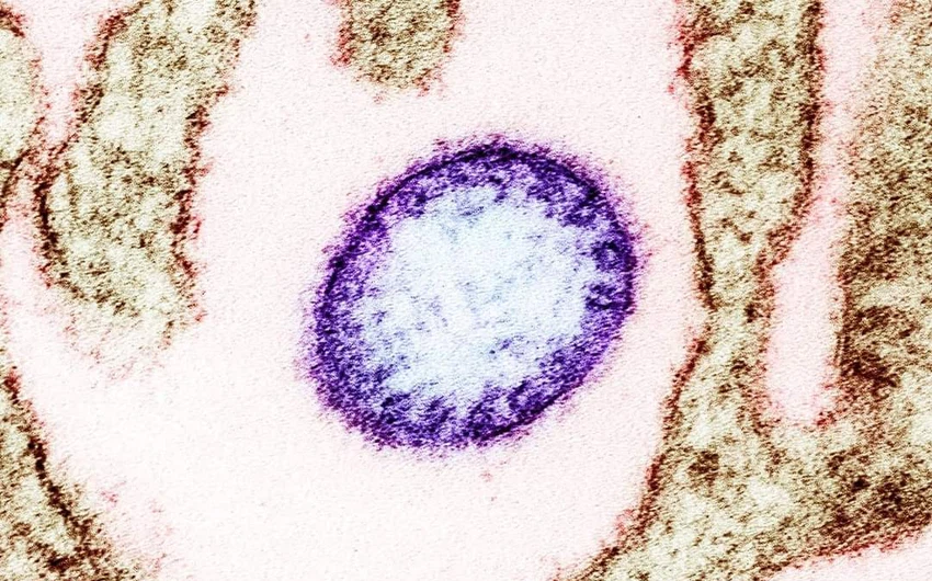 فيروس نيباه ليس بجديد !
