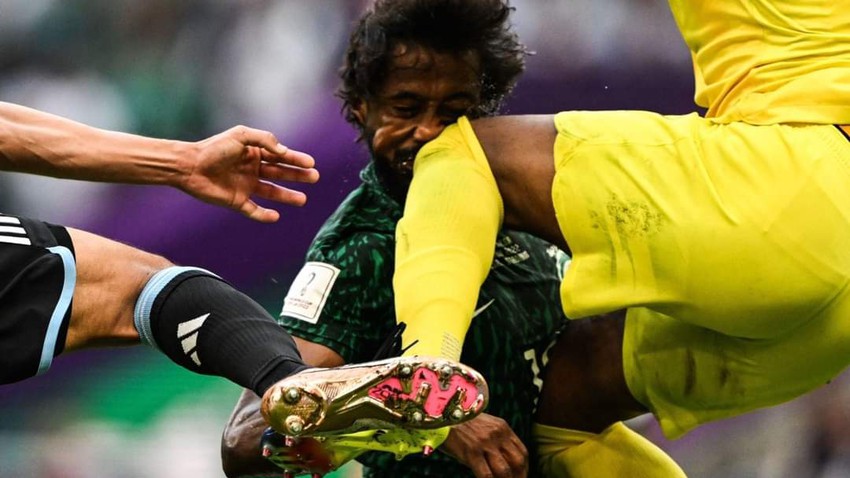 Coupe du monde 2022 | Yasser Al-Shahrani a subi une fracture de la mâchoire et des os du visage, ainsi que des dommages aux dents, et il subira une intervention chirurgicale urgente