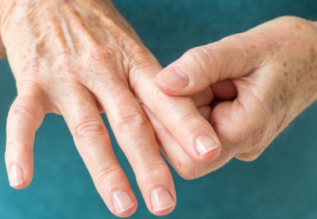 ألم التهاب المفاصل والطقس طقس العرب