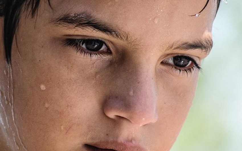 تحليل فرط التعرق اختبار فرط التعرق