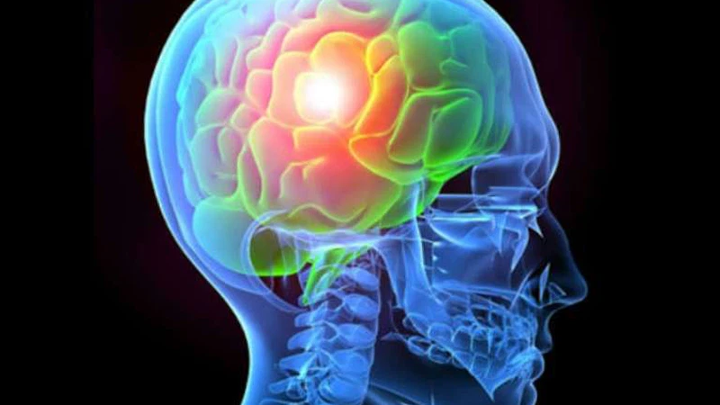 تعبيرية اللقاحات المضادة للإنفلونزا تقي من الجلطة الدماغية