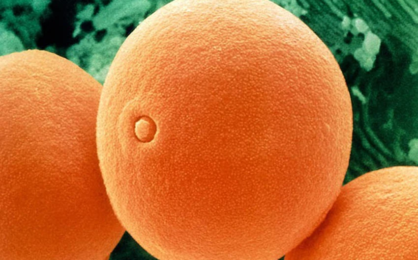قد تكون على شكل البرتقال و لكنها حبيبات اللقاح مكبرة على المجهر