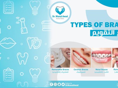 عيادة الدكتورة منال عوض لطب الأسنان  -  Dr. Manal Awad Dental Clinic
