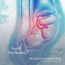 Dr. Eyas Battikhi - الدكتور اياس غالب البطيخي