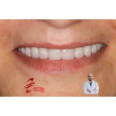عيادة د.غانم الكيالي لطب الأسنان