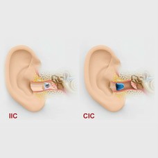 Nas medical and Hearing - شركة ناس للاجهزه الطبية والسمعيه