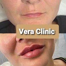 Vera Dermalaser Clinic