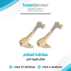 عيادة الدكتور طاهر عضيبات لجراحة العظام والمفاصل