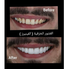 Majdalawi Dental clinic / عيادة الدكتور احمد مجدلاوي